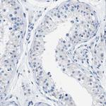 Apolipoprotein L1 Polyclonal Antibody