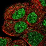 RNF12 Polyclonal Antibody