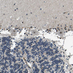 RNF12 Antibody in Immunohistochemistry (Paraffin) (IHC (P))