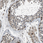 RNF12 Antibody in Immunohistochemistry (Paraffin) (IHC (P))