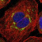 CES2 Antibody in Immunocytochemistry (ICC/IF)