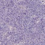 CES2 Antibody in Immunohistochemistry (Paraffin) (IHC (P))