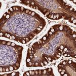 CES2 Antibody in Immunohistochemistry (Paraffin) (IHC (P))