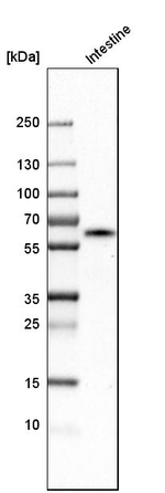 CES2 Antibody in Western Blot (WB)