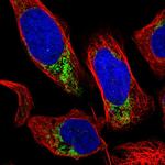 GRK6 Polyclonal Antibody