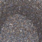 GRK6 Antibody in Immunohistochemistry (Paraffin) (IHC (P))