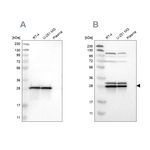 ETFB Antibody in Western Blot (WB)