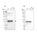 ETFB Antibody in Western Blot (WB)