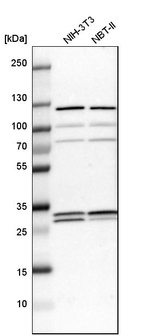 ETFB Antibody in Western Blot (WB)