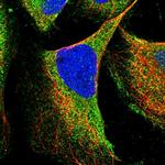 RNF216 Polyclonal Antibody