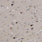 RNF216 Antibody in Immunohistochemistry (Paraffin) (IHC (P))