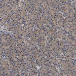 RNF216 Antibody in Immunohistochemistry (Paraffin) (IHC (P))