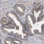 RNF216 Antibody in Immunohistochemistry (Paraffin) (IHC (P))