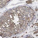 RNF216 Antibody in Immunohistochemistry (Paraffin) (IHC (P))