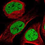 CtBP1 Antibody in Immunocytochemistry (ICC/IF)