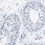 CtBP1 Antibody in Immunohistochemistry (Paraffin) (IHC (P))