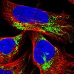 TUFM Polyclonal Antibody