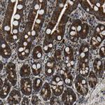 TUFM Antibody in Immunohistochemistry (Paraffin) (IHC (P))