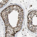TUFM Antibody in Immunohistochemistry (Paraffin) (IHC (P))