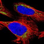 ETFA Polyclonal Antibody