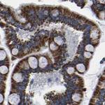 ETFA Antibody in Immunohistochemistry (Paraffin) (IHC (P))