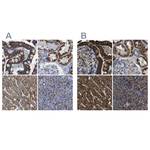ETFA Antibody in Immunohistochemistry (Paraffin) (IHC (P))