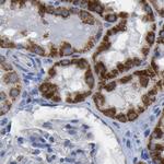 ETFA Antibody in Immunohistochemistry (Paraffin) (IHC (P))