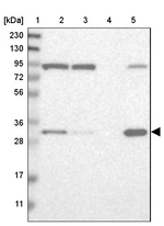 ETFA Antibody in Western Blot (WB)