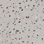 Importin 7 Polyclonal Antibody