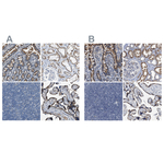 ACADVL Antibody in Immunohistochemistry (Paraffin) (IHC (P))