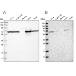 ACADVL Antibody in Western Blot (WB)