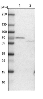 ACADVL Antibody in Western Blot (WB)