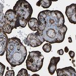 CALM Antibody in Immunohistochemistry (Paraffin) (IHC (P))