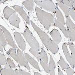 CALM Antibody in Immunohistochemistry (Paraffin) (IHC (P))