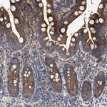 CDKN2C Polyclonal Antibody