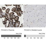 CALM Antibody in Immunohistochemistry (Paraffin) (IHC (P))