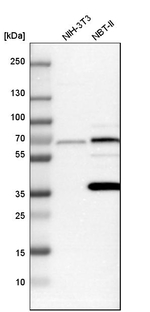 CALM Antibody in Western Blot (WB)