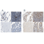 CAPG Antibody in Immunohistochemistry (Paraffin) (IHC (P))