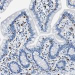 CAPG Antibody in Immunohistochemistry (Paraffin) (IHC (P))