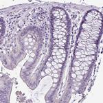 VAM1 Polyclonal Antibody