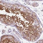 VAM1 Antibody in Immunohistochemistry (Paraffin) (IHC (P))