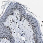 NIPA Antibody in Immunohistochemistry (Paraffin) (IHC (P))