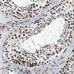 NIPA Antibody in Immunohistochemistry (Paraffin) (IHC (P))