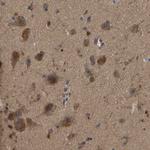 GARS Antibody in Immunohistochemistry (Paraffin) (IHC (P))