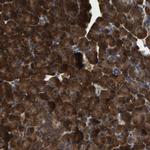 GARS Antibody in Immunohistochemistry (Paraffin) (IHC (P))