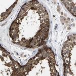 GARS Antibody in Immunohistochemistry (Paraffin) (IHC (P))