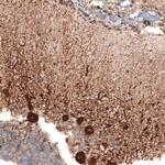 STAU2 Polyclonal Antibody