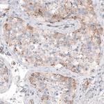 STAU2 Antibody in Immunohistochemistry (Paraffin) (IHC (P))