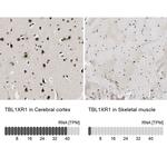 TBLR1 Antibody