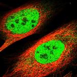 TBLR1 Polyclonal Antibody